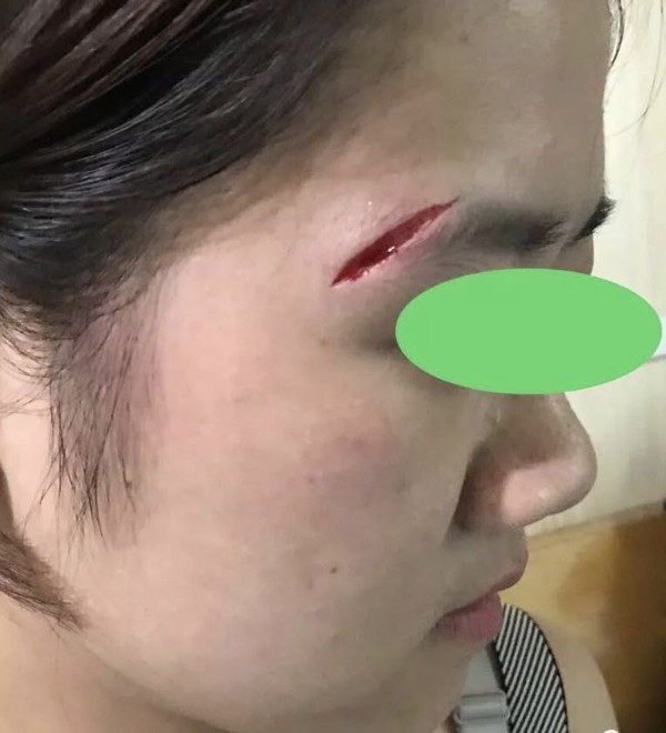 美容縫合前.jpg