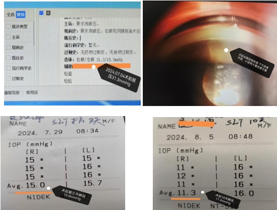 ba33c62a4f312f6a02f8c4d6c26d904.png